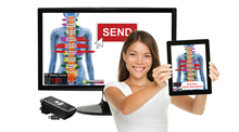 Load image into Gallery viewer, MyoVision ScanVision